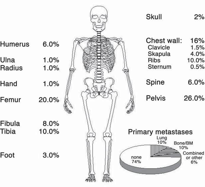 Ewing-Sarcoma-Primary-Tumor-Sites